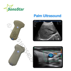 Sonostar 96 Elements Wireless Ultrasound Probe  CP-3L or 3C machine WIFI scanner color doppler linear or Convex  Pocket portable